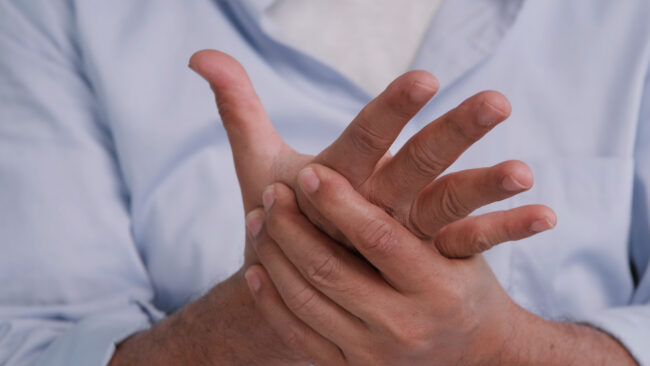 An Asian man has tingling and numbness in his hand which causes beriberi.