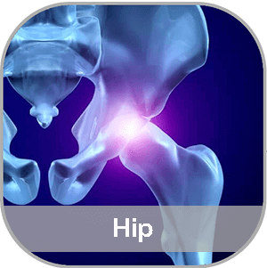 Hip condition treatment
