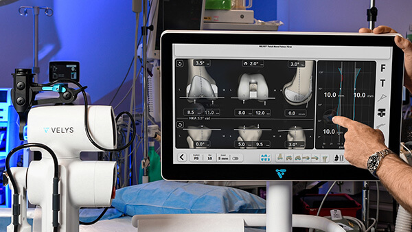 Robotic-Assisted Knee Replacement