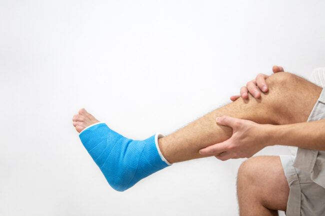 Blue splint ankle. Bandaged leg cast on male patient on white background isolated. Sports injury concept.
