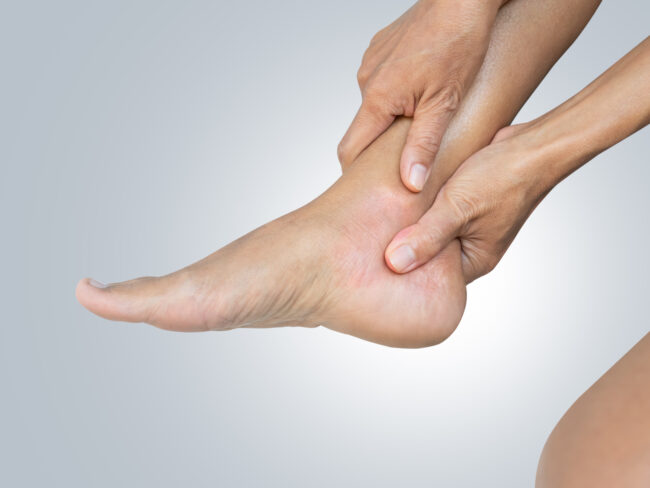 Sore ankle Pain Foot Woman, Sprain Feet Heel Knee Sore People Chronic Joint Leg Hurt Injury Bone Arthritis Skeleton Girl Accident Fitness Sport Exercise Medical Care Treatment Massage,Osteoarthritis