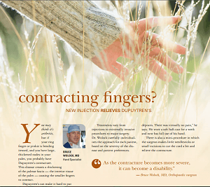 Dr. Wolock treats Dupuytren's contracture using varying techniques.