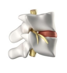 Image showing the anatomy of a vertebral segment